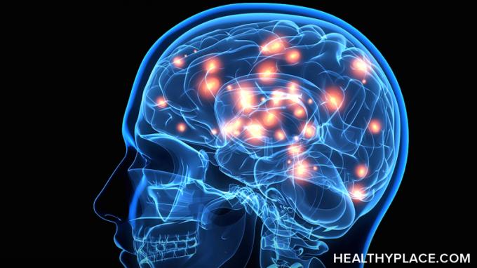 По какво се различава мозъкът на болестта на Паркинсон? Разберете как Паркинсън влияе върху мозъка и какво се показва при сканиране на мозъка, тук в HealthyPlace. 