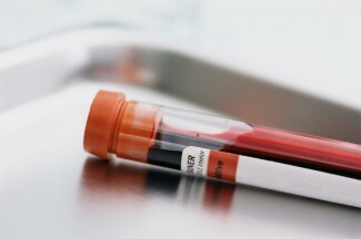 Наскоро беше обявен кръвен тест за прогнозиране на повишен риск от самоубийство, но можем ли наистина да прогнозираме риск от самоубийство с обикновен кръвен тест?