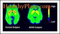 Термините ADD и ADHD са използвани взаимозаменяемо. Въпреки това, актуализираният термин, според DSM IV, е ADHD (хиперактивност с дефицит на вниманието).