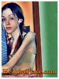 В тази снимка за самонараняване момиче с анорексия също се забърква в самонараняване, като чука и натъртва части от тялото си